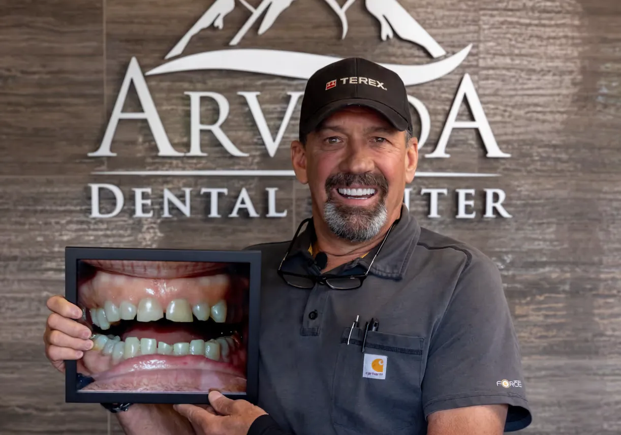 Chris' Dental Implants and Veneers Story