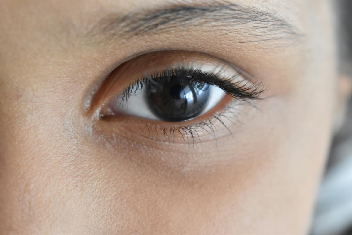 Polynucleotide injections under-eye dark circles treatment London