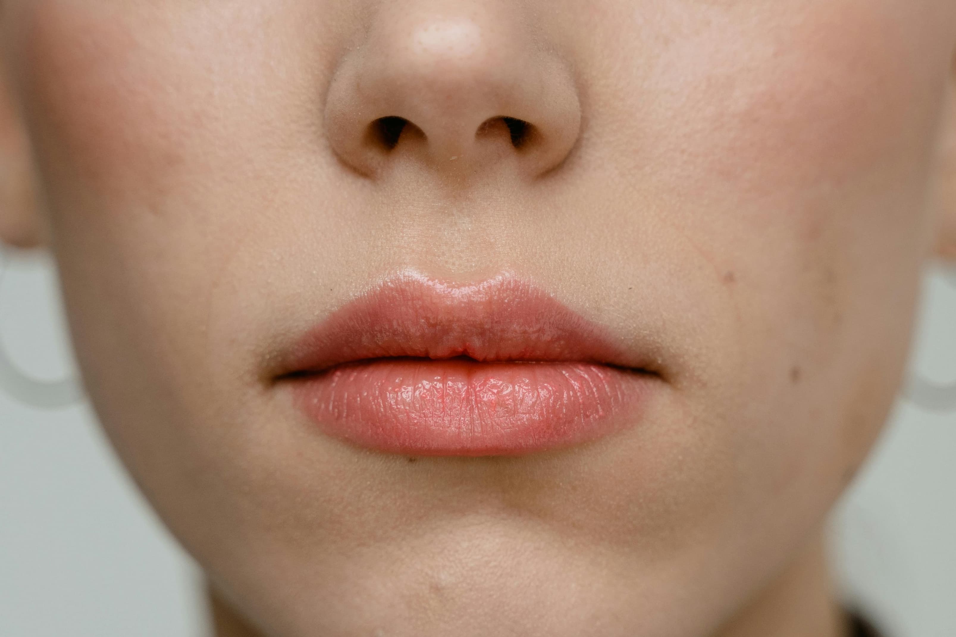 Lip filler cost London guide DimAllure Wimpole Street
