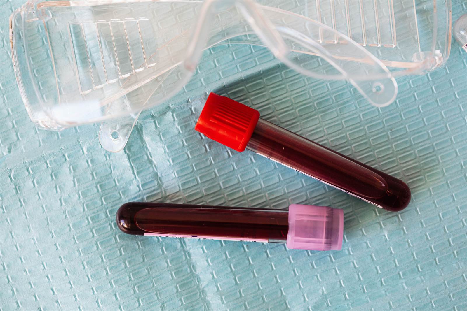 Blood test sample tubes prepared for laboratory analysis before a medical weight management programme