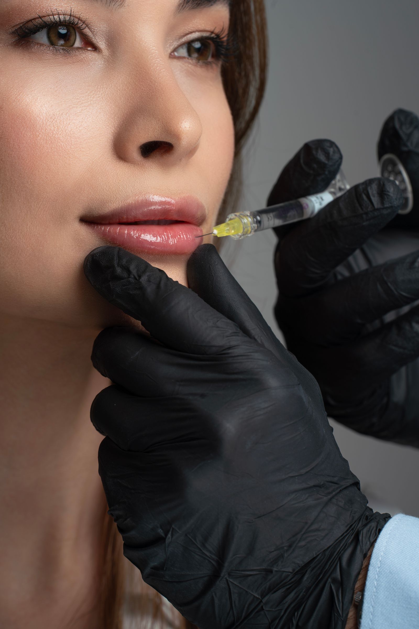 Practitioner assessing a patient's lips before a filler dissolving consultation at a London aesthetics clinic