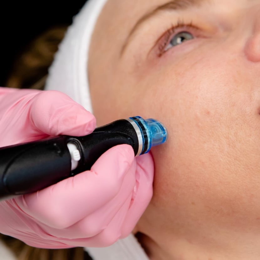 Nano Hydrafacial + Booster Package