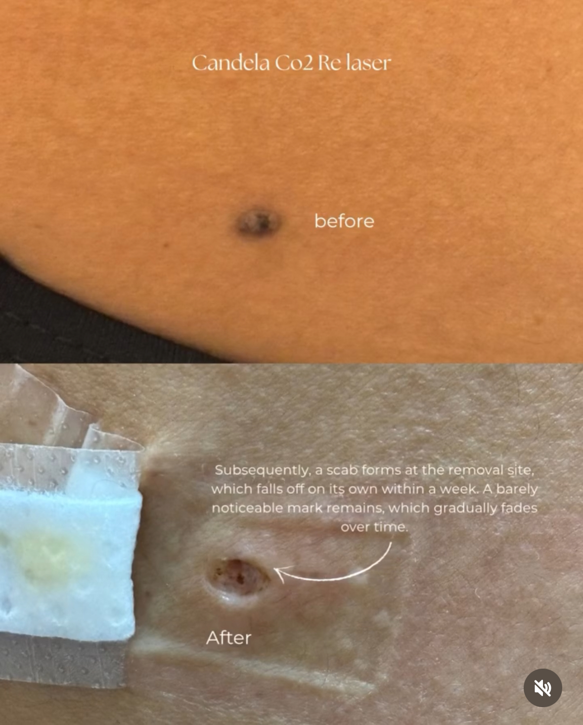 Recovery Aftercare BeautyGene Clinic