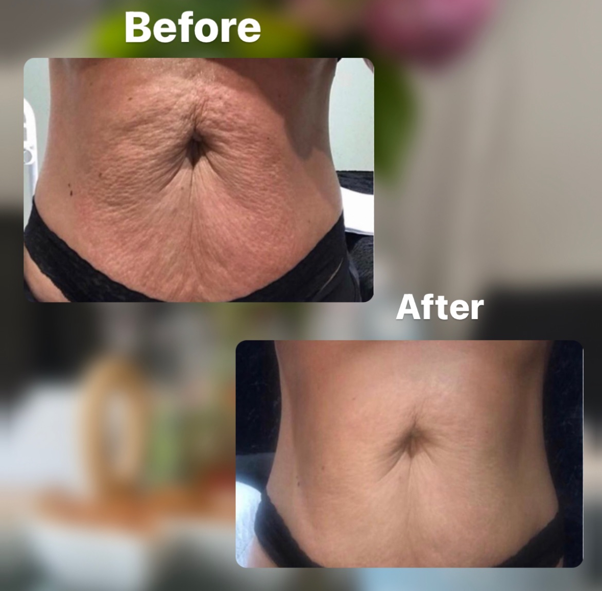 T-Shape result before after