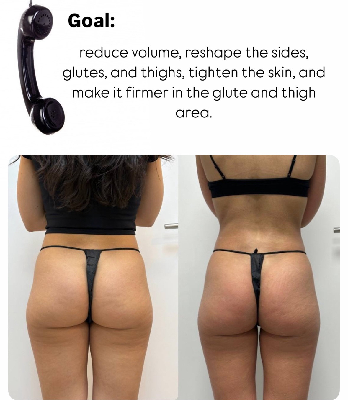 T-Shape result before after