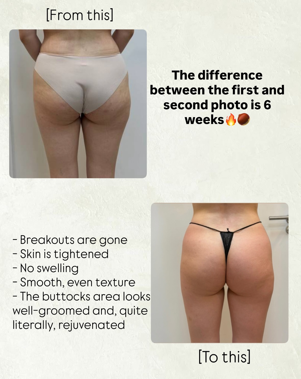 T-Shape result before after