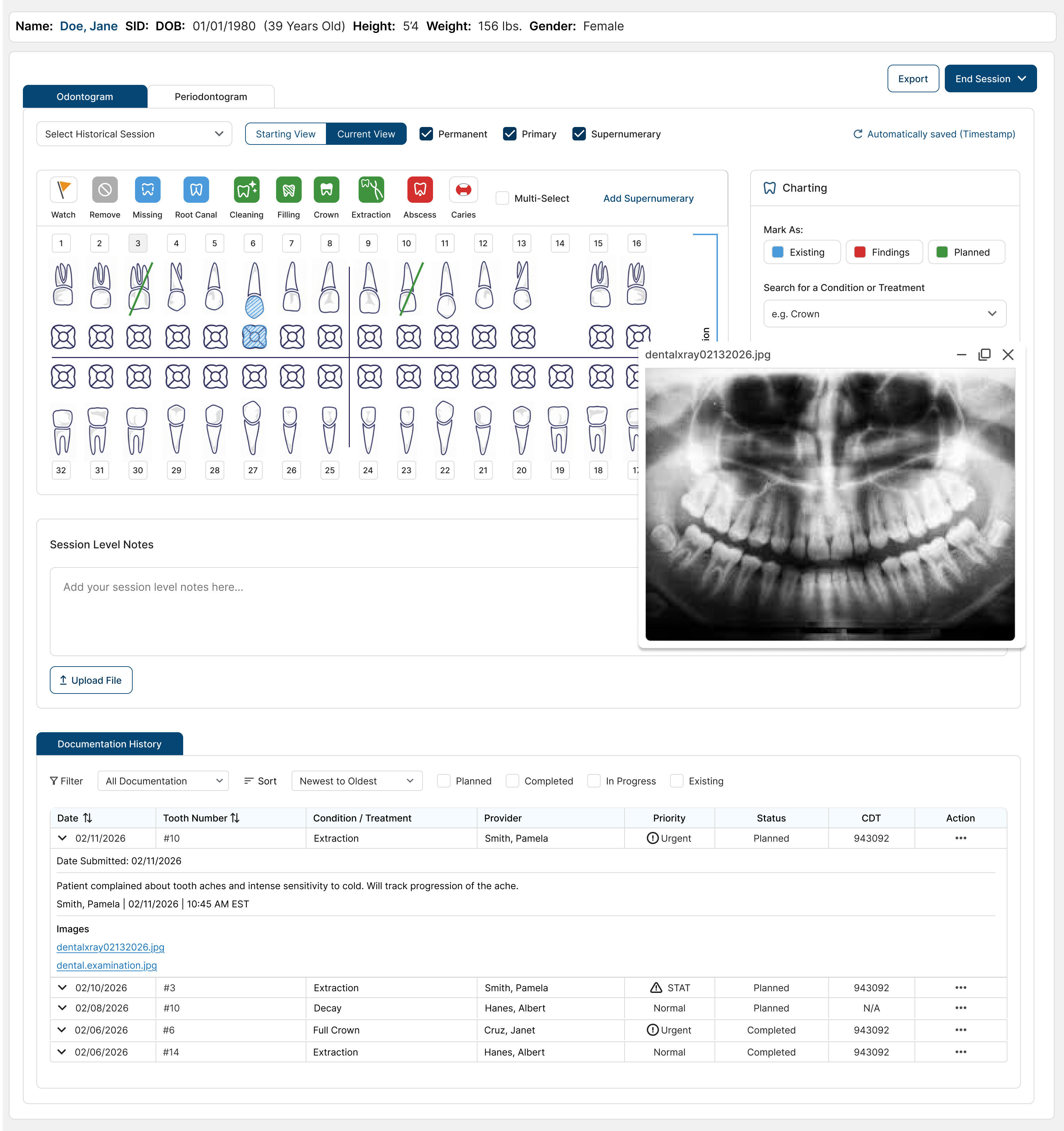 Odontogram screen showing treatment planning tied to a charted condition.