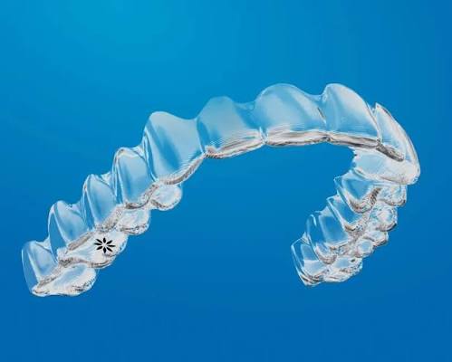 Invisalign clear aligners shown for comparison with Damon braces