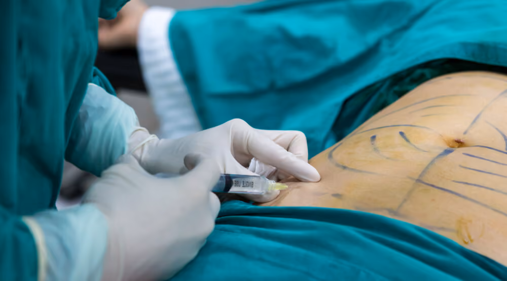 como acontece cirurgia lipoescultura