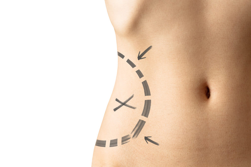 quanto custa lipoescultura