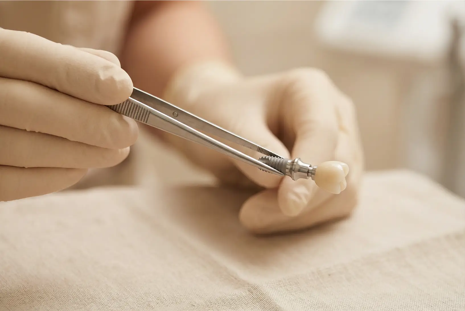 01-dental-implants