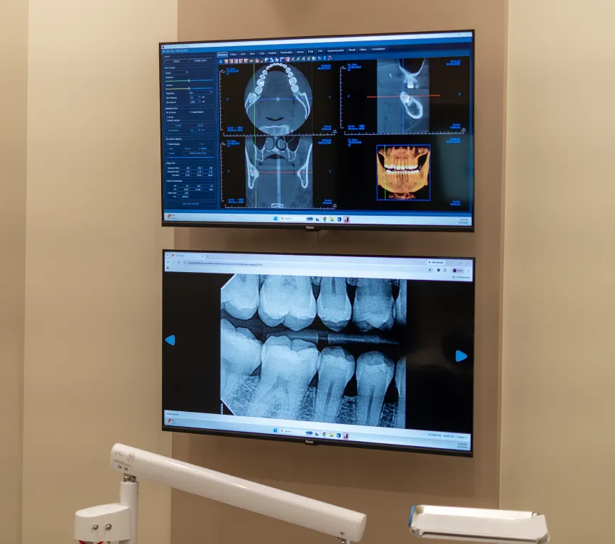 Root Canal Therapy at Aram Dental Studio, Scottsdale, AZ