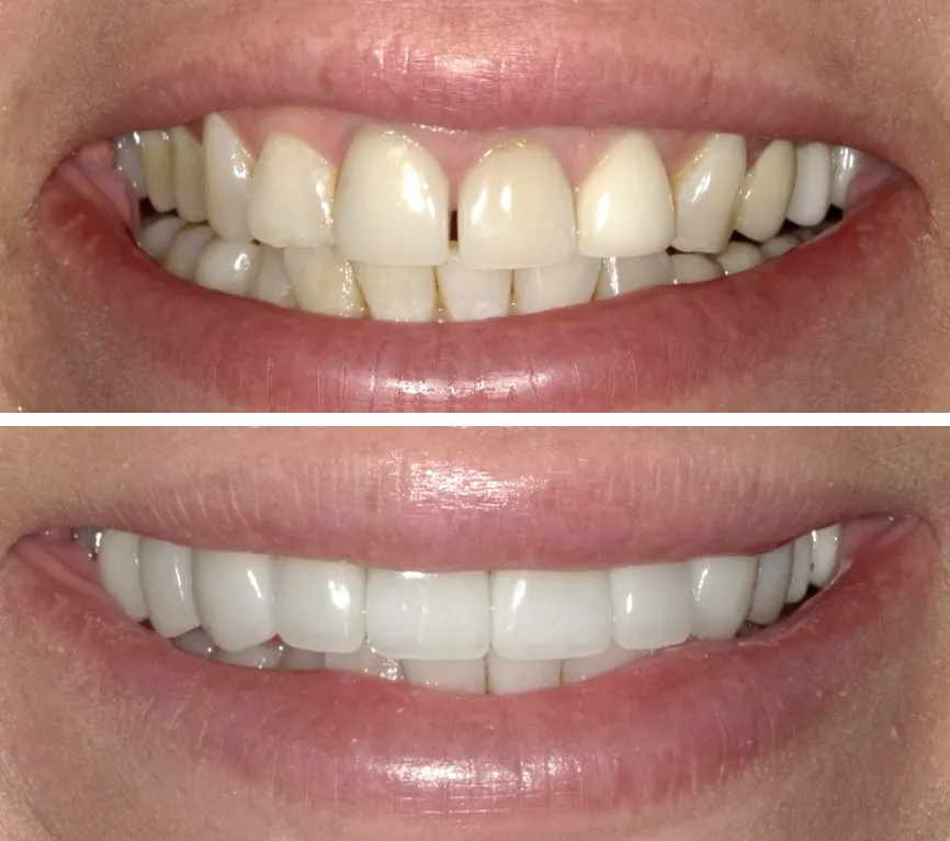 Smile Design Consult at Aram Dental Studio