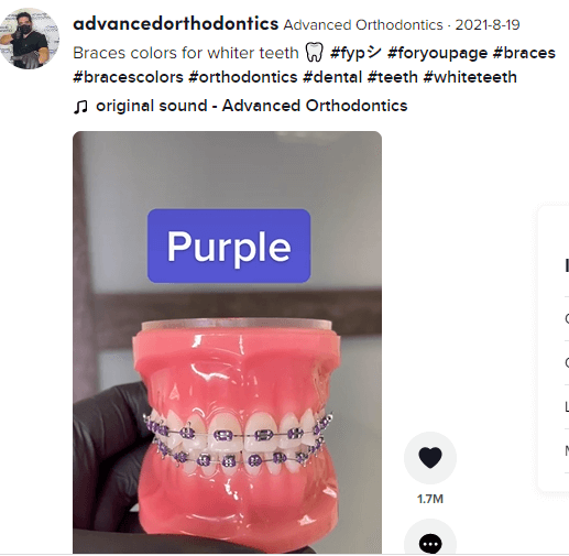 Advanced orthodontics TikTok content showing which braces color can make teeth look whiter.