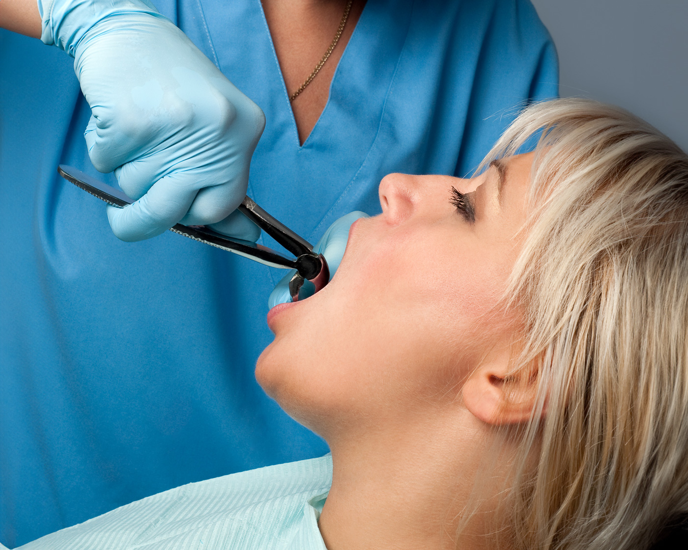 Tooth Extractions
