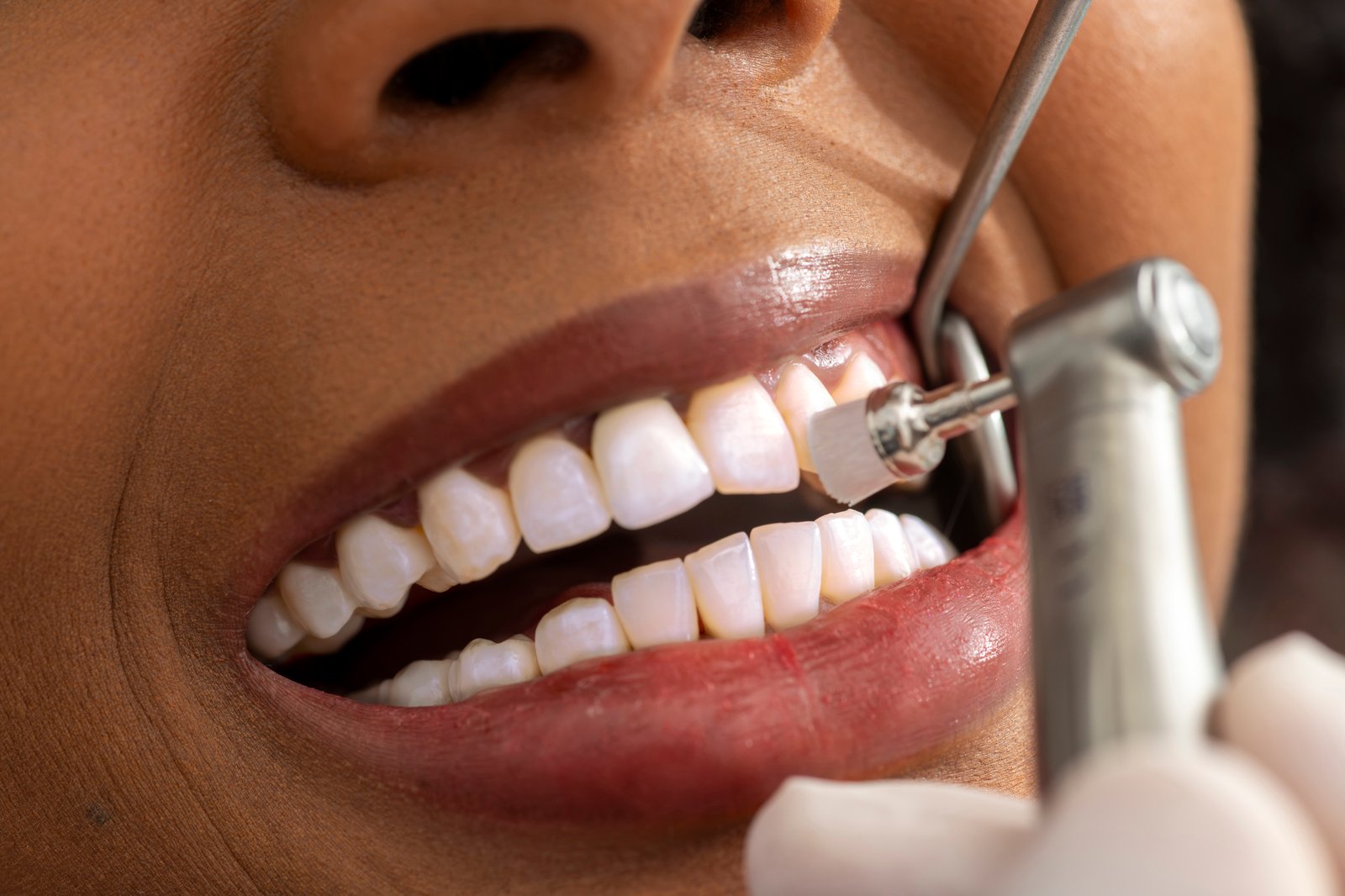 Dental Teeth Cleaning | Rai Family Dentistry