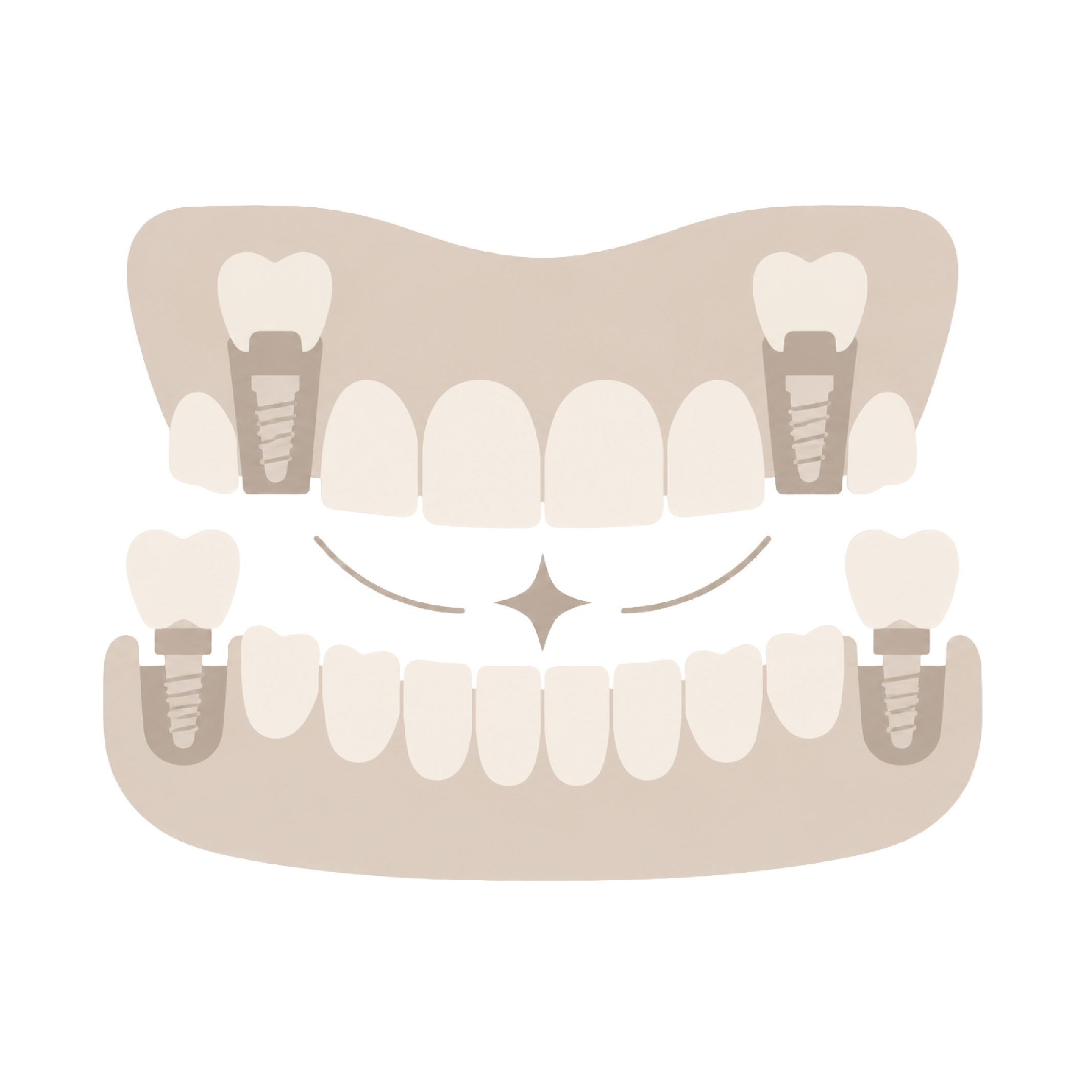 Full Mouth Reconstruction