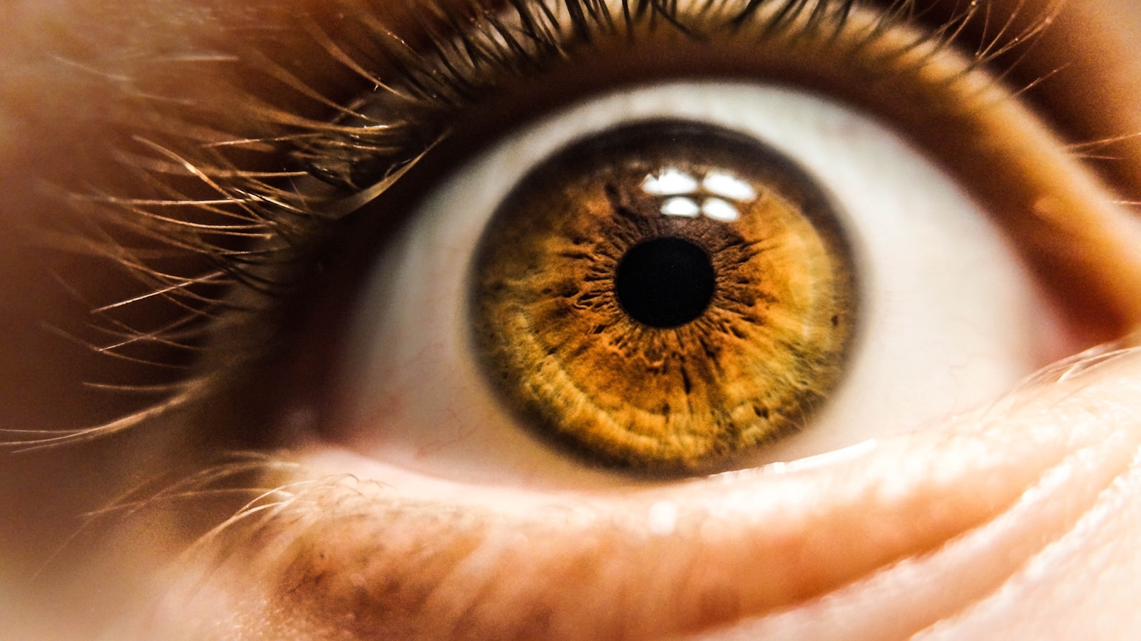 Close-up of a brown human eye relevant to strabismus eye alignment surgery