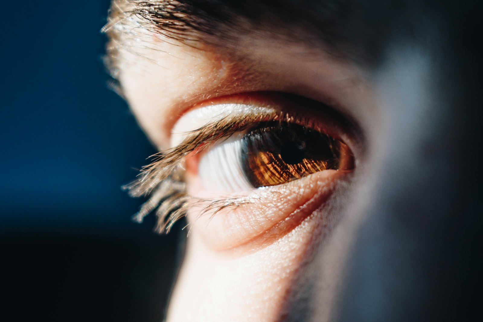 Close-up of a person's eye relevant to corneal cross-linking treatment