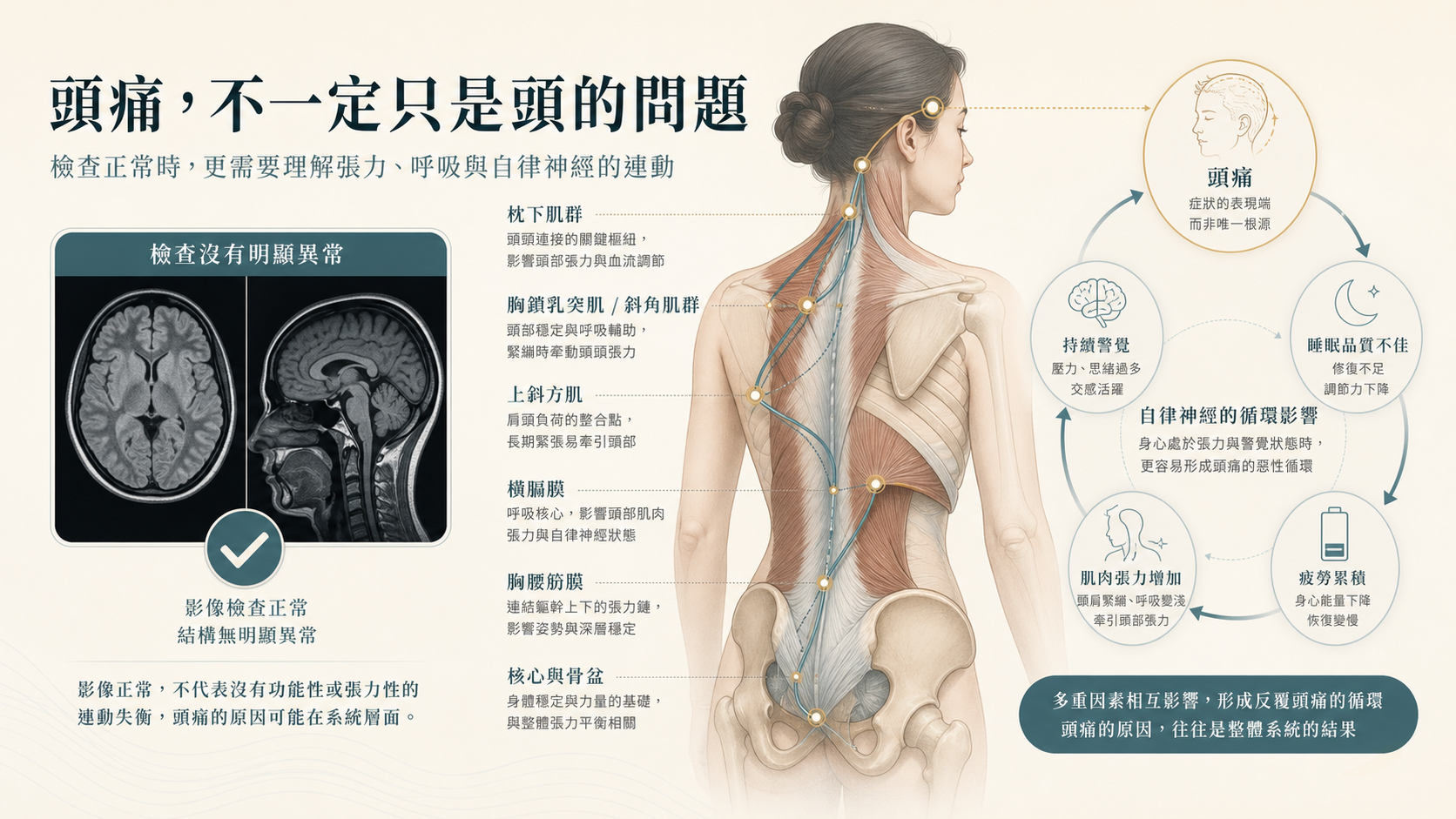 為什麼有些人的頭痛一直找不到原因？