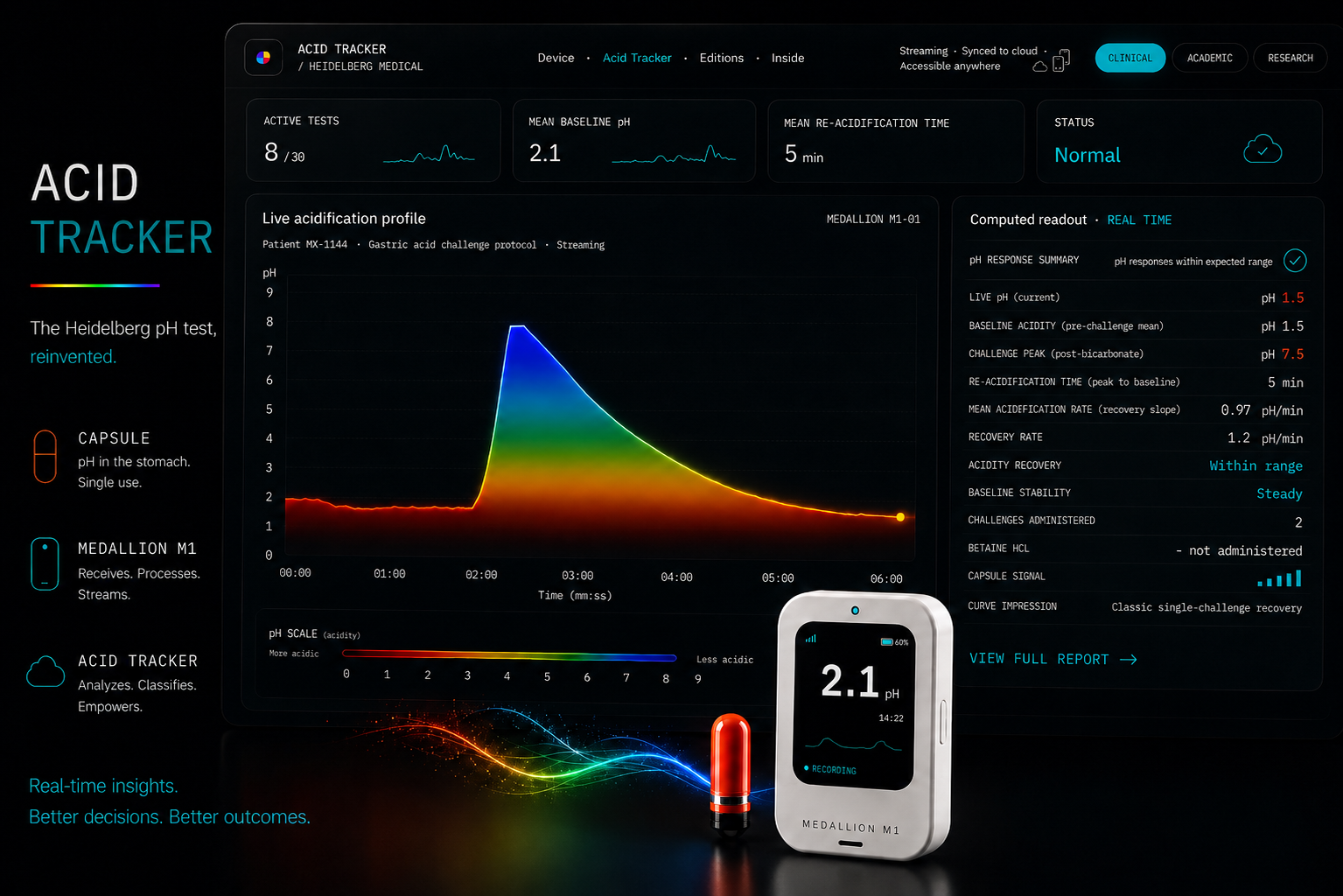 The Acid Tracker dashboard plotting a live gastric acidification profile in real time, beside the Medallion M1 reader