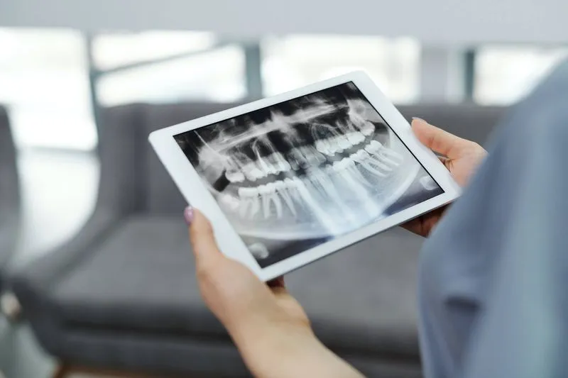 Teeth Straightening