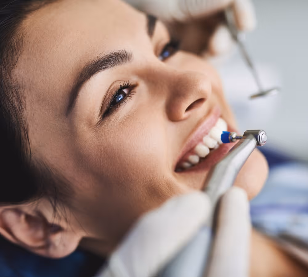 Teeth Whitening in Milwaukee 