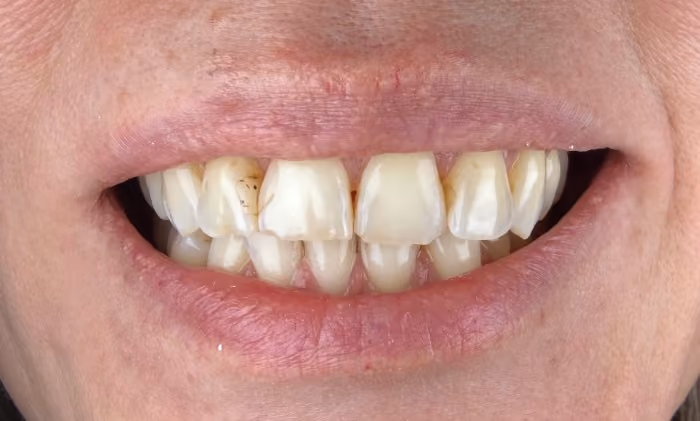 Before Image
