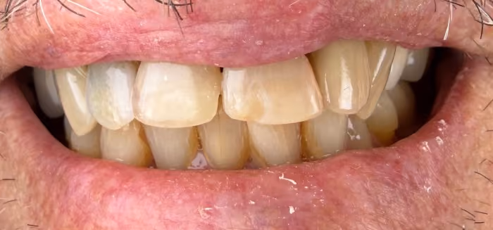After Image