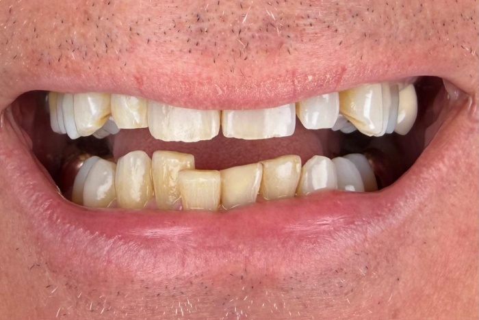 Before Image