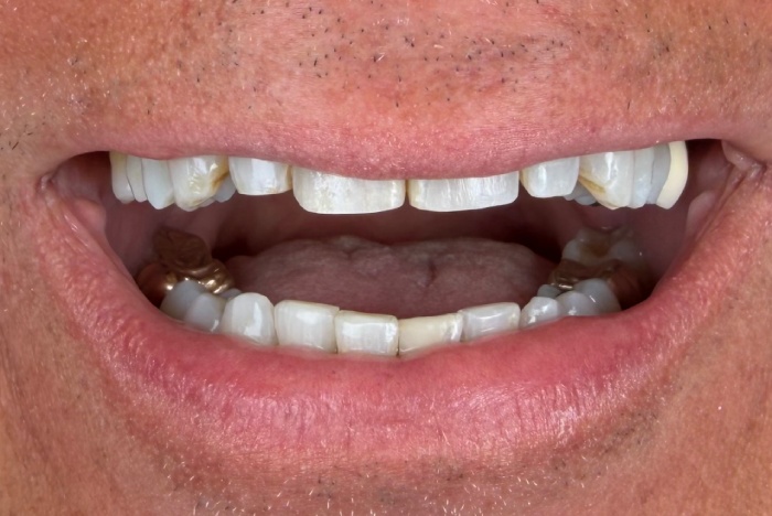 After Image