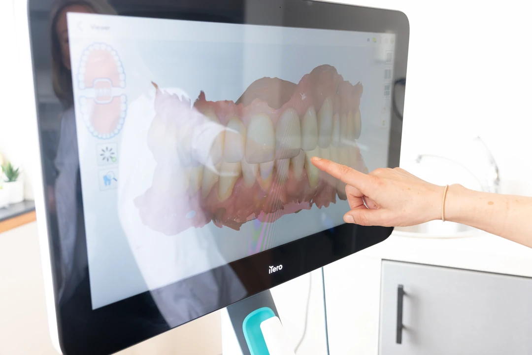 Cosmetic Dentist in Milwaukee