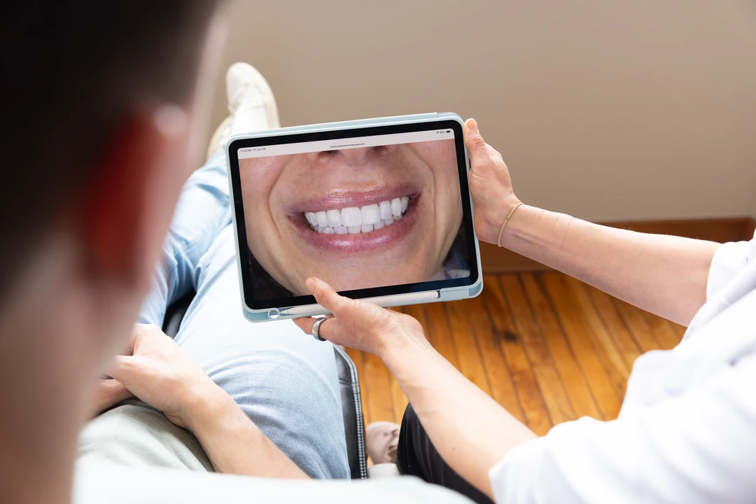 Teeth Whitening in Milwaukee