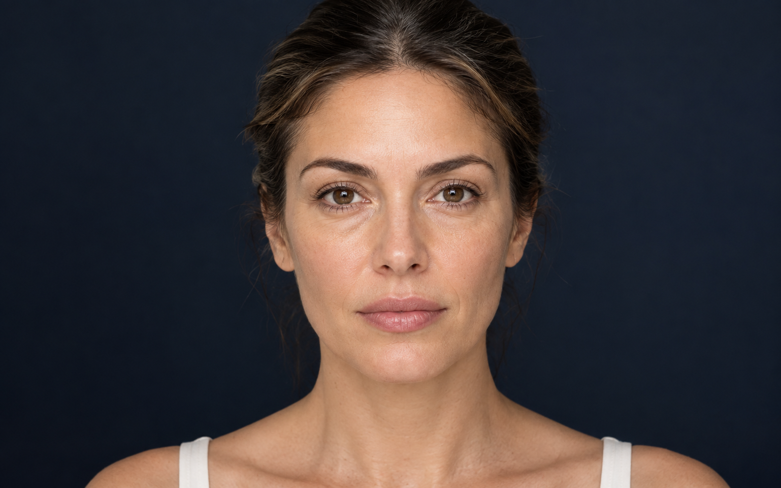 Illustrative face before treatment, showing mid-face volume loss and a tired under-eye area