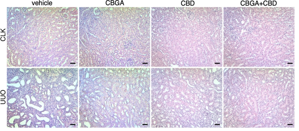 H&E staining of kidney tissue after treatment with a vehicle control, CBGA, CBD, or CBD and CBGA.