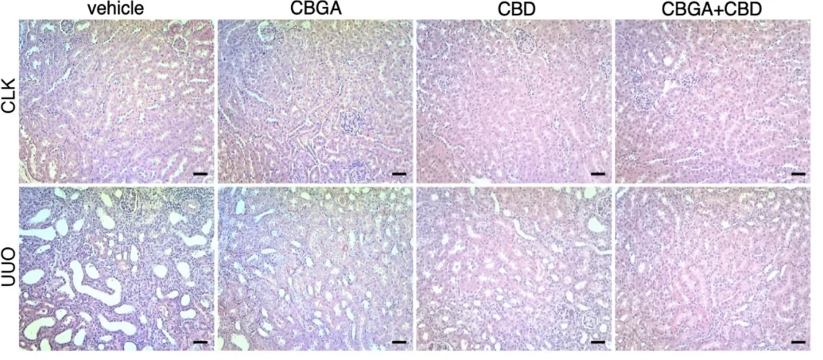 H&E staining of kidney tissue after treatment with a vehicle control, CBGA, CBD, or CBD and CBGA.