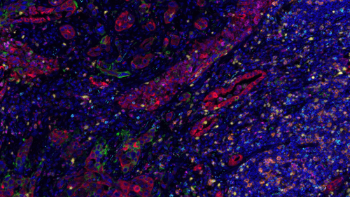Insights from Spatial Biology in Drug Discovery at IRBM: The Impact of Cellular Ecosystems