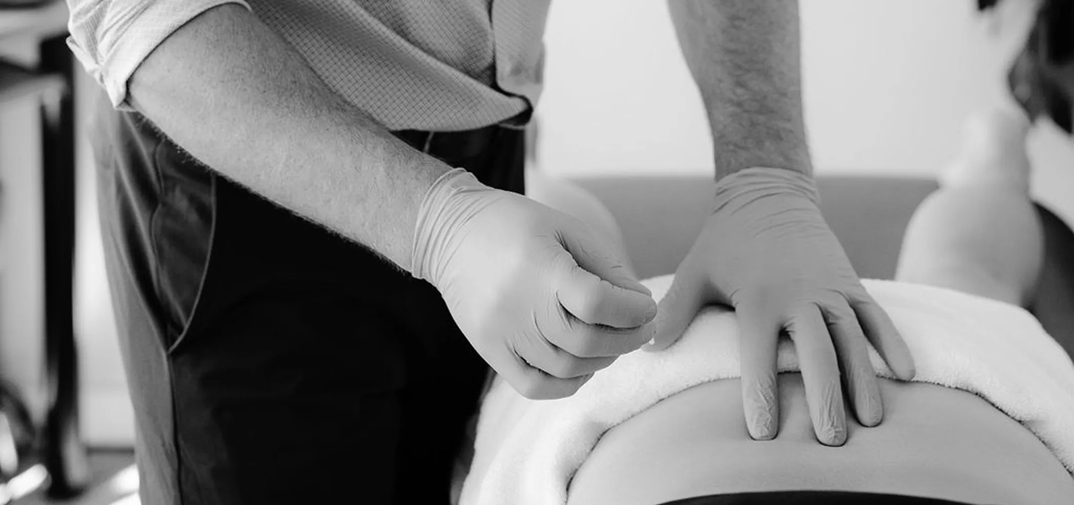 Practitioner wearing gloves performing acupuncture on a person's back.