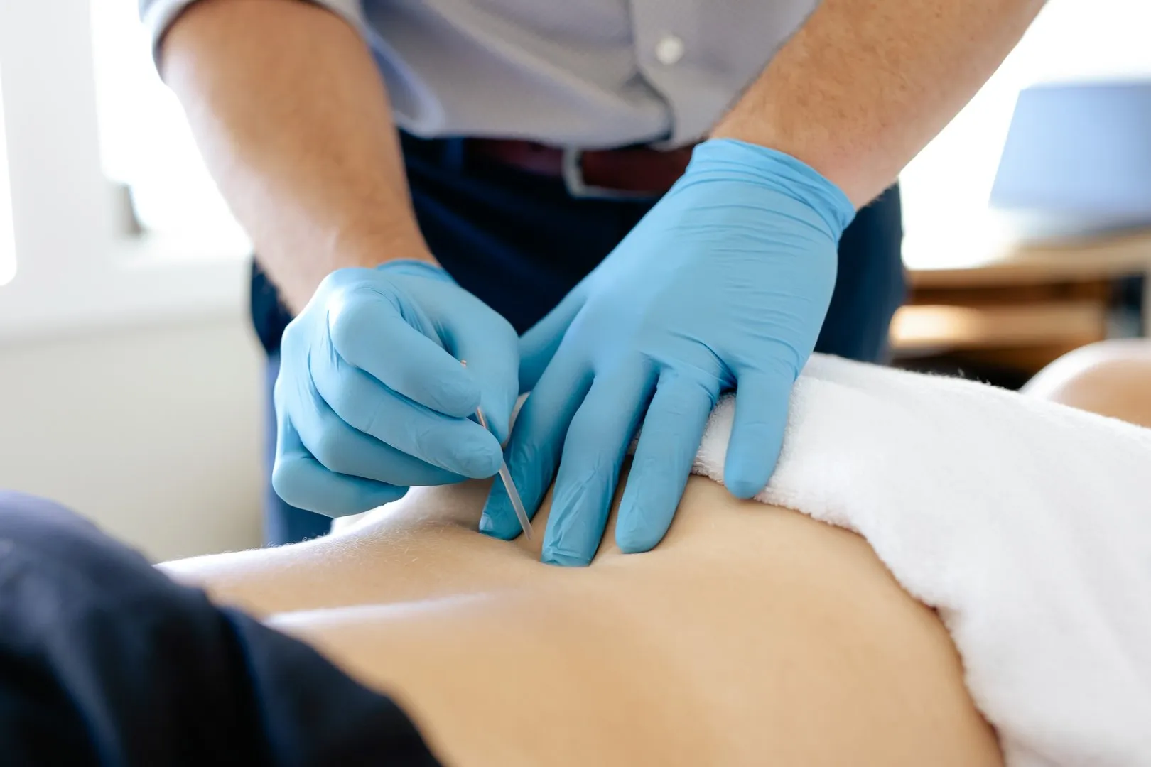 Hands in blue gloves inserting acupuncture needle into lower back of a person lying down.