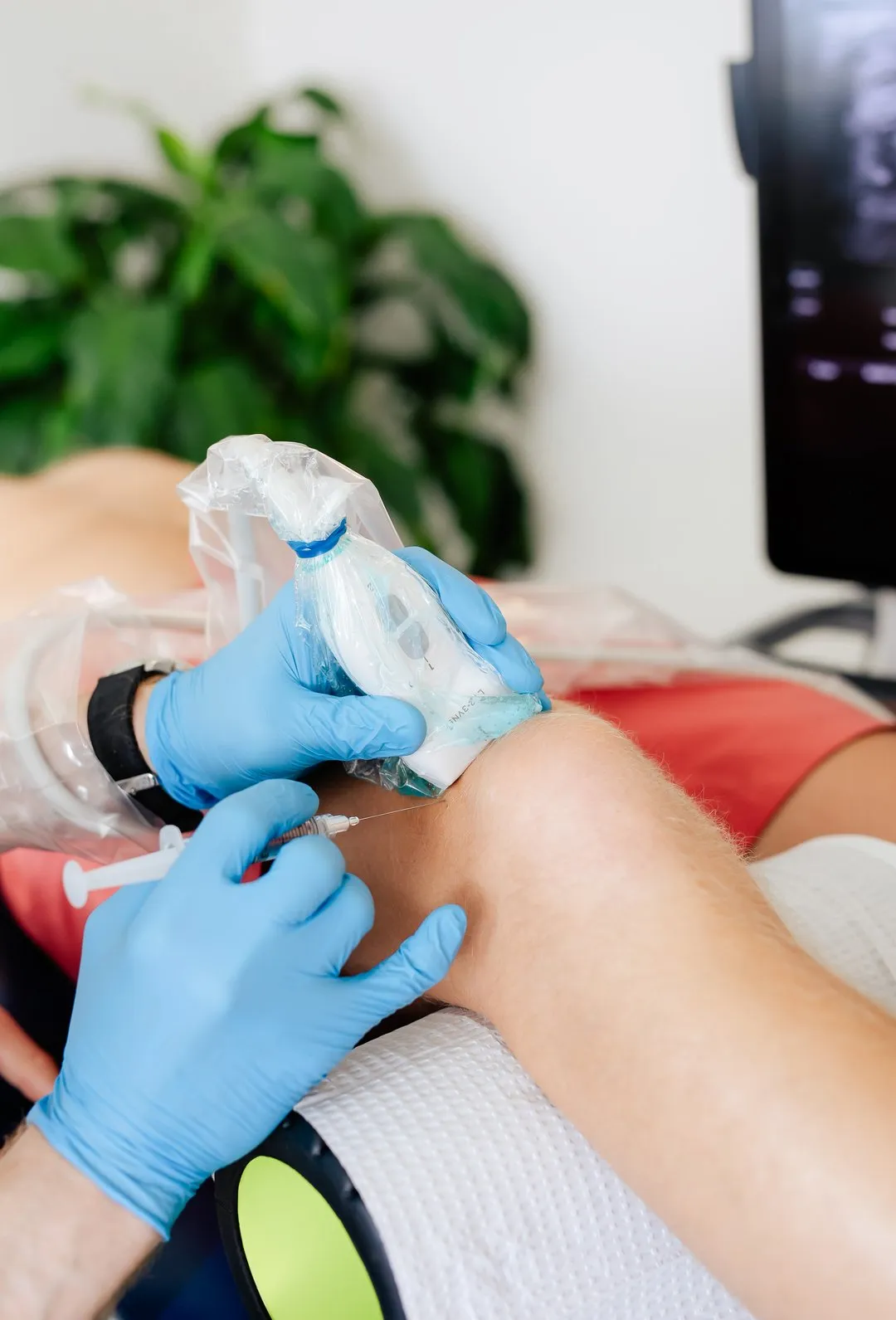 Medical professional wearing blue gloves injecting knee with a syringe during ultrasound-guided procedure.