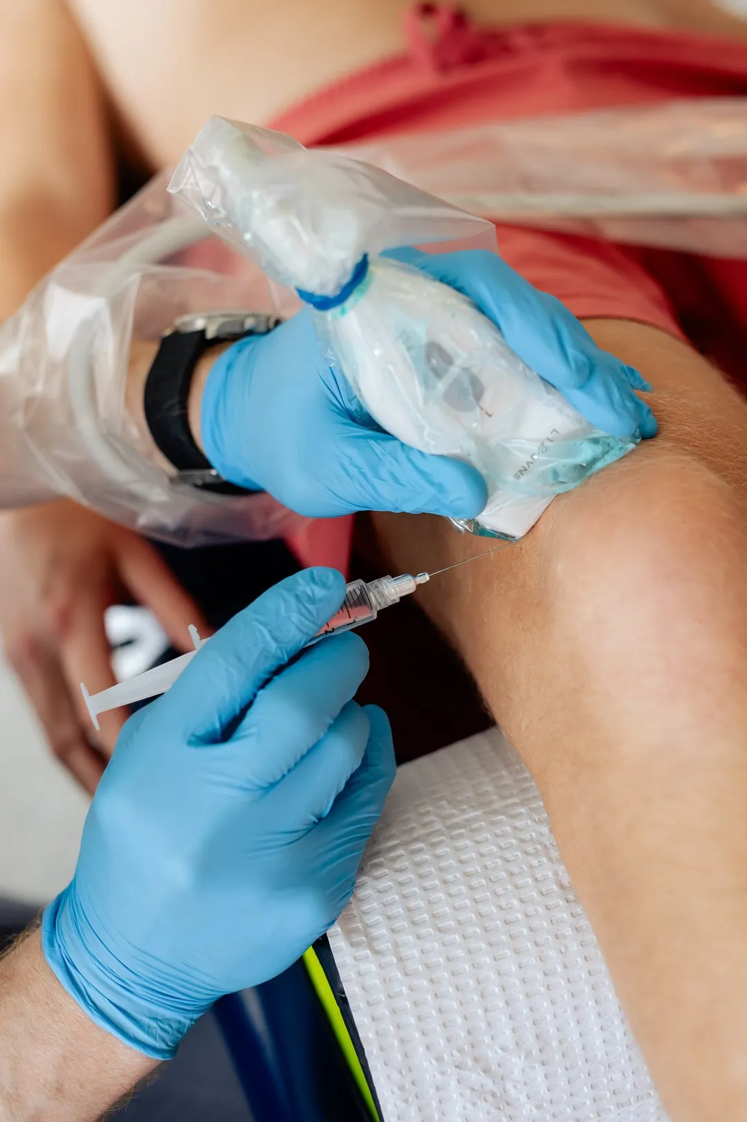 Medical professional in blue gloves injecting a knee with a syringe while holding an ice pack.