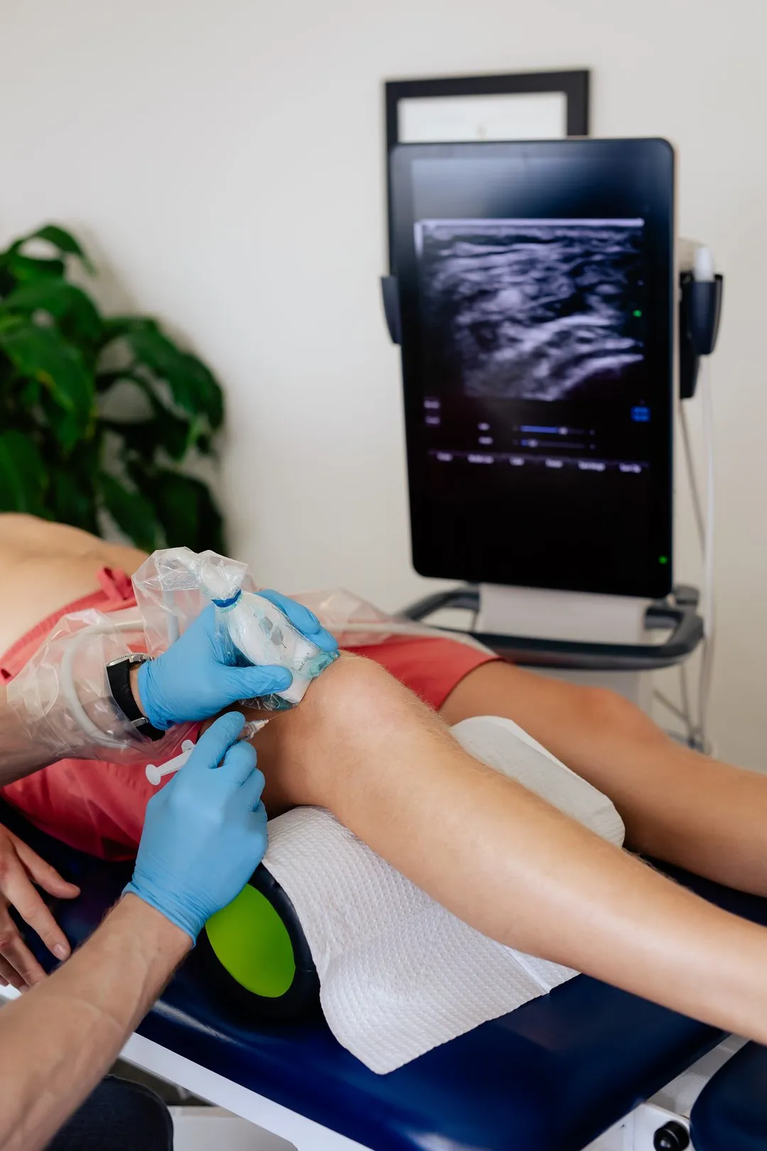 Gloved hands performing knee ultrasound-guided injection on a patient lying on a medical table.