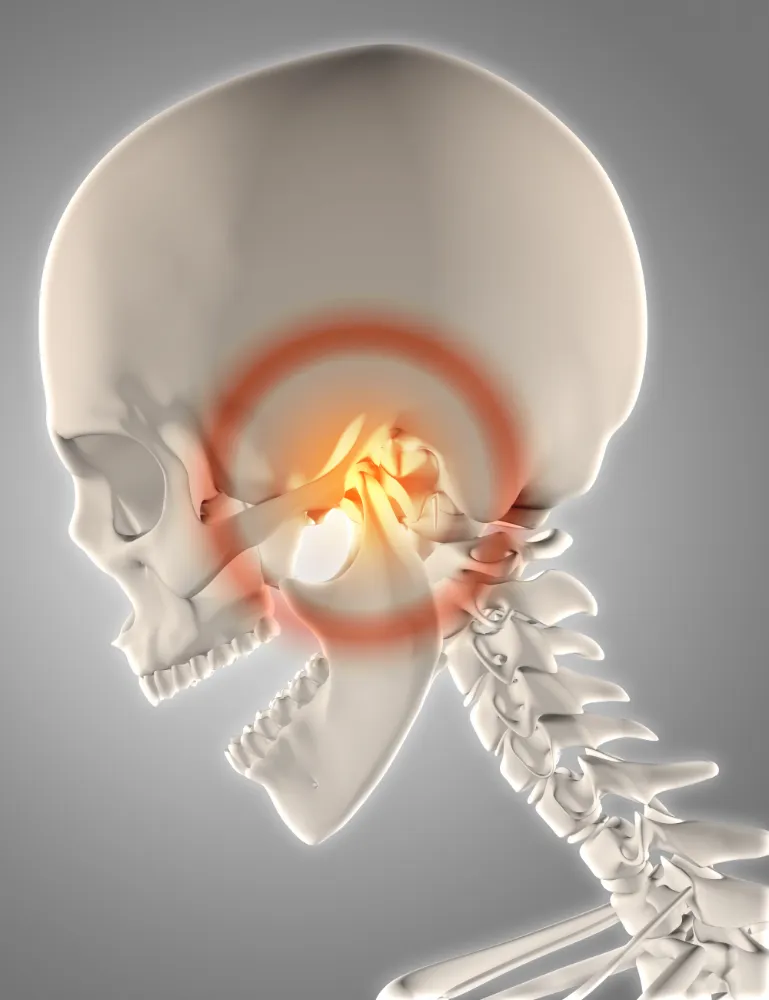 Side view of a human skull and spine with red target marking jaw joint pain area.
