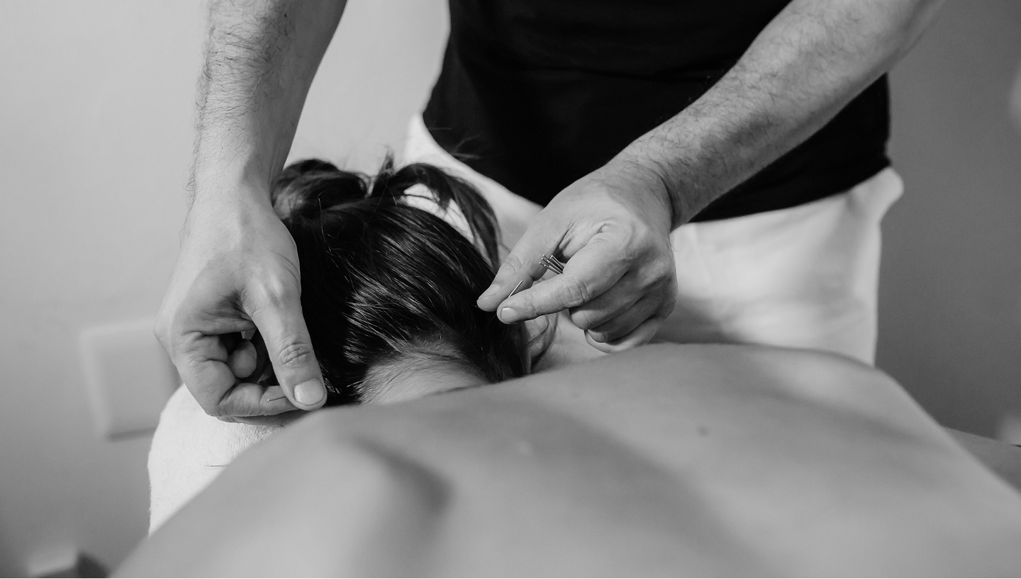 Acupuncturist performing needle therapy on a patient’s upper back and neck during a clinical treatment session.