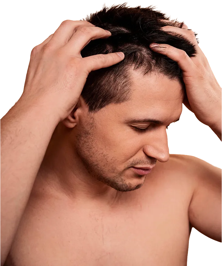 Man touching his scalp and looking down, showing signs of scalp irritation or rosacea.