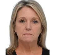Middle-aged woman with blonde hair showing chin dimpling and neutral facial expression.