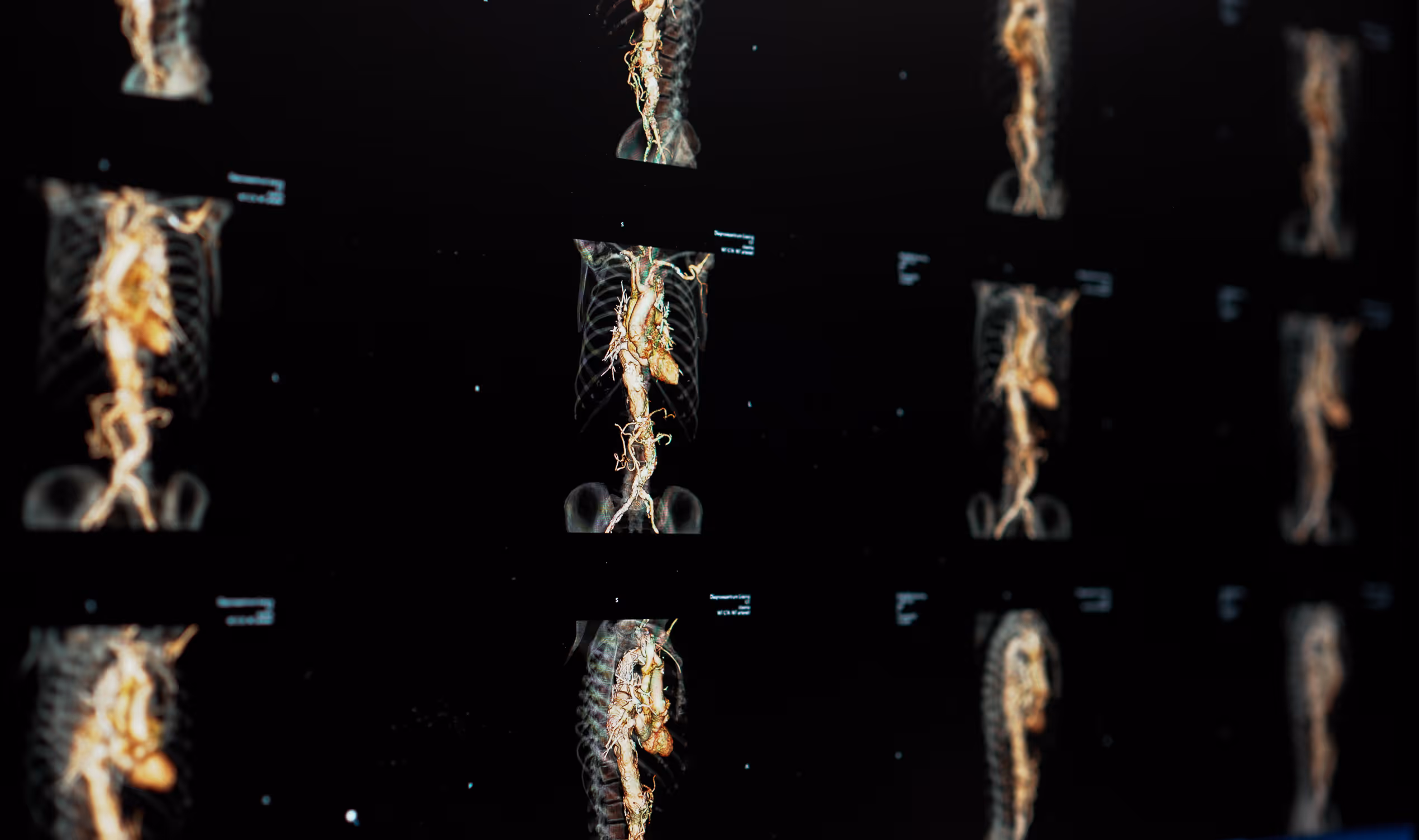 Mehrere 3D-MRT-Bilder des menschlichen Skeletts und Herz-Kreislauf-Systems auf schwarzem Hintergrund.