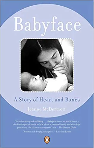 Babyface: A Story of Heart and Bones by Jeanne McDermott