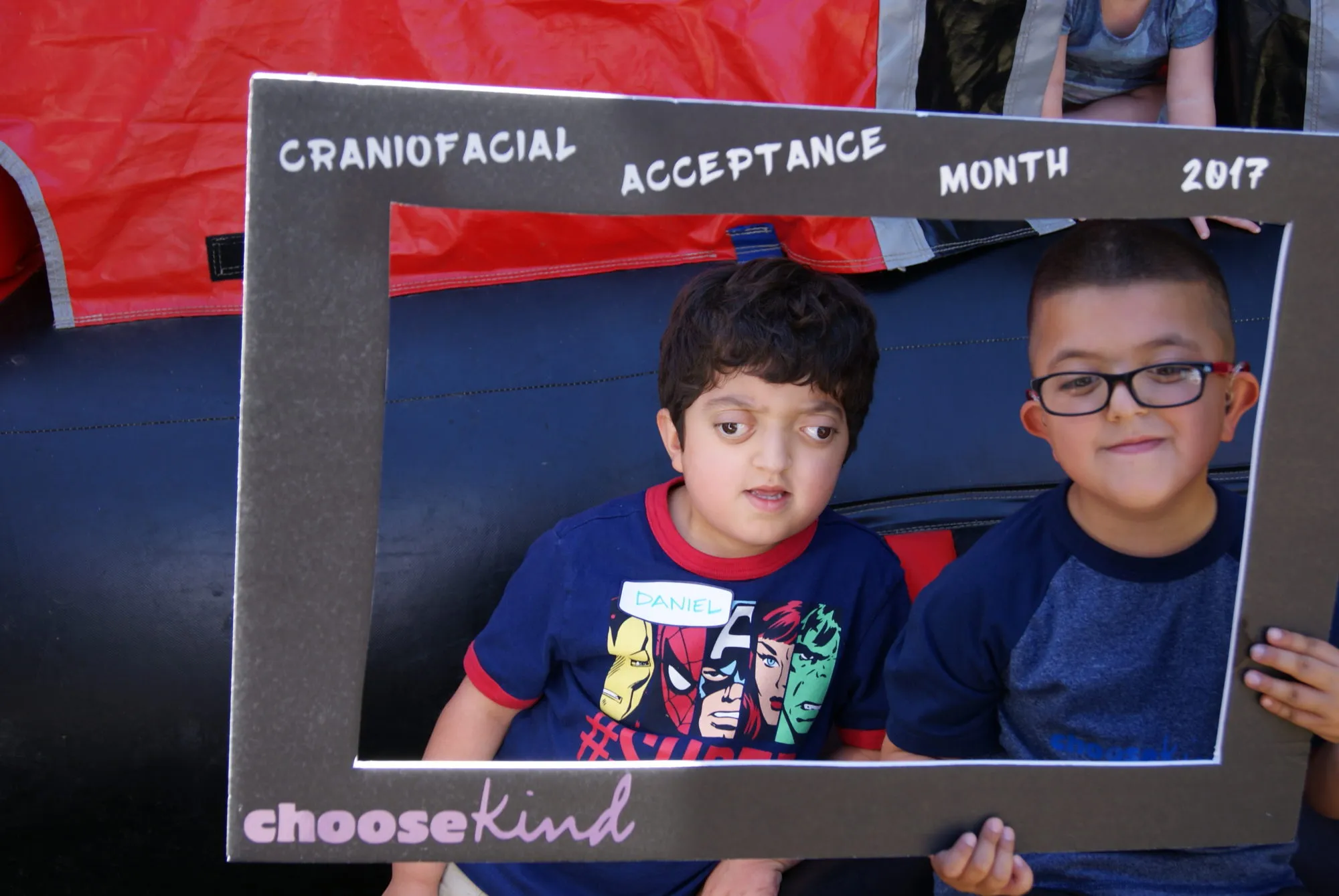 Two boys pose inside a "Craniofacial Acceptance Month — Choose Kind" photo frame