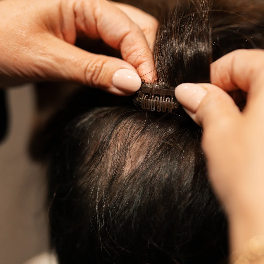 Handen bevestigen een haarstukje met een klem op dun haar met zichtbare hoofdhuid.